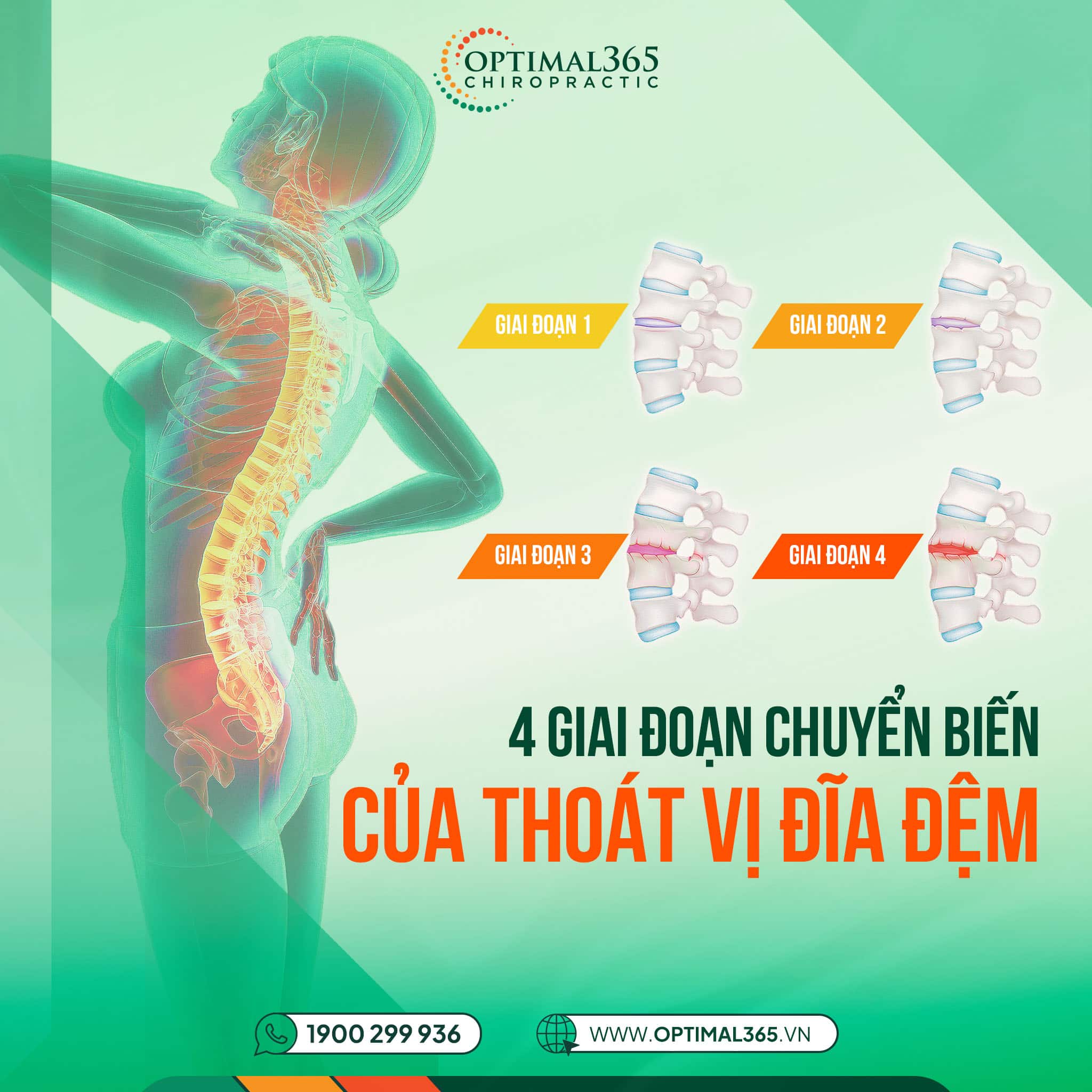 4 Giai Đoạn Chuyển Biến Của Thoát Vị Đĩa Đệm