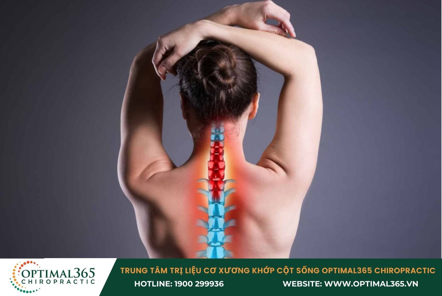 Thoát vị đĩa đệm cổ là gì?