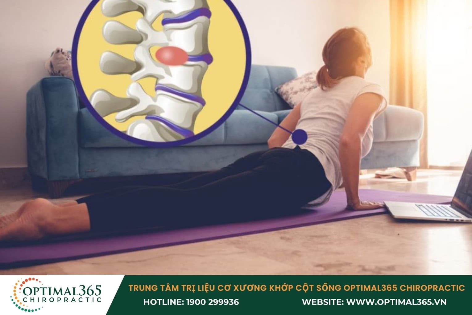 Người thoát vị đĩa đệm hạn chế điều gì để tránh biến chứng?