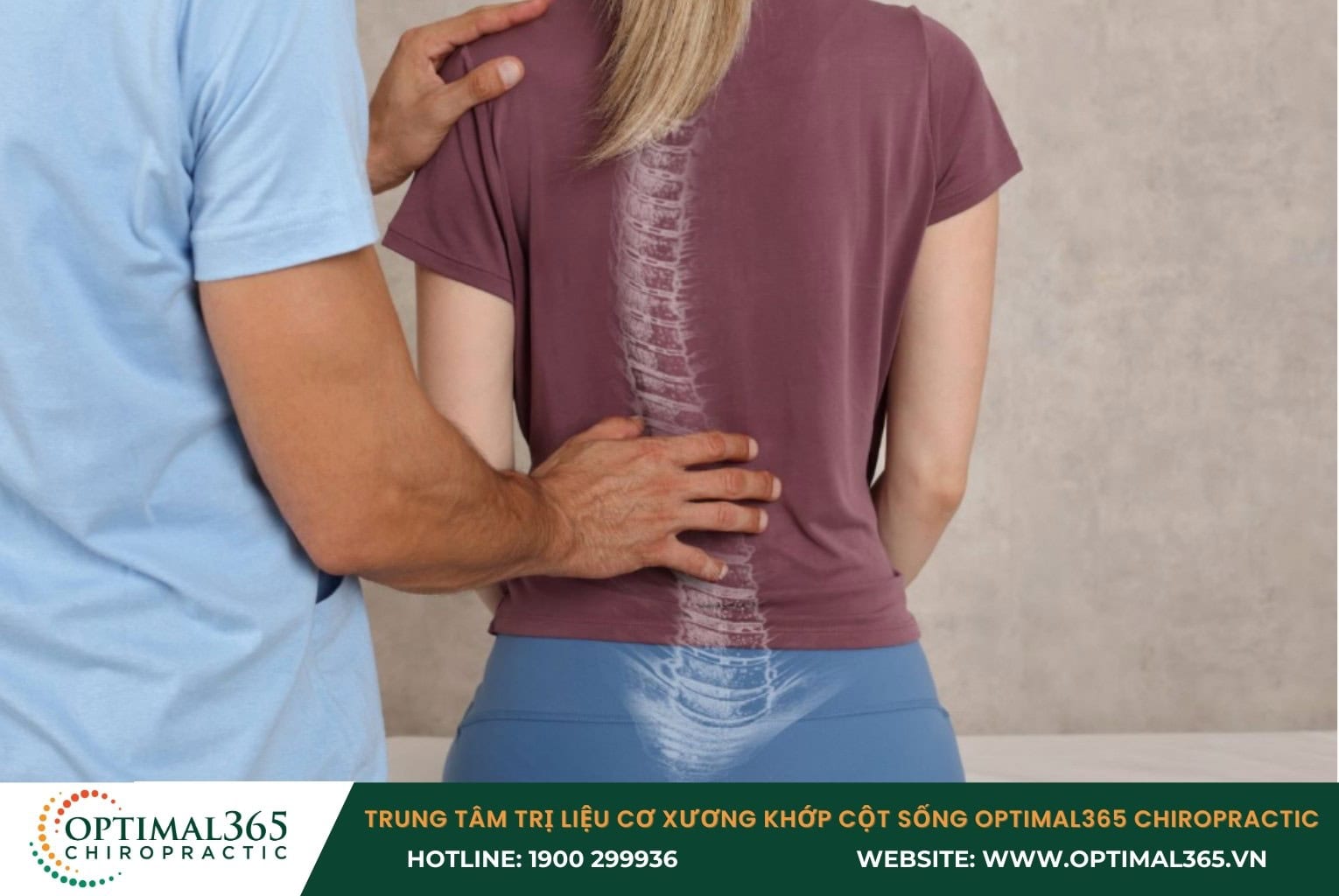 Cập nhật chi phí chữa cong vẹo cột sống hiện nay