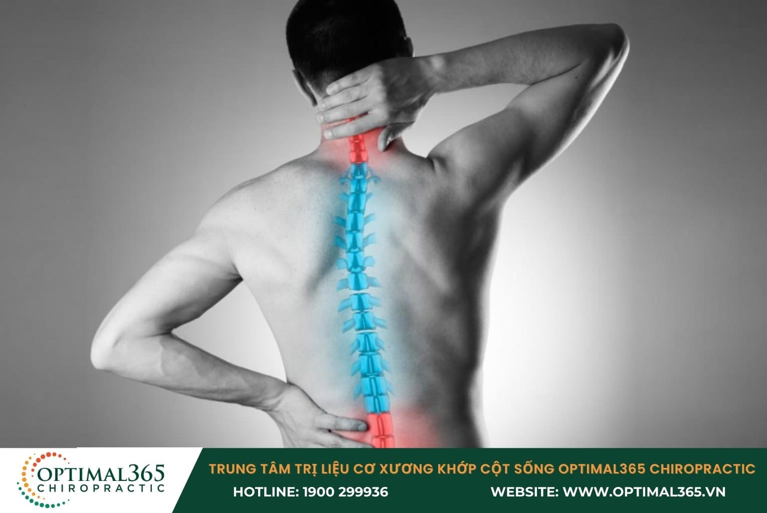 Các phương pháp chữa vẹo cột sống phổ biến