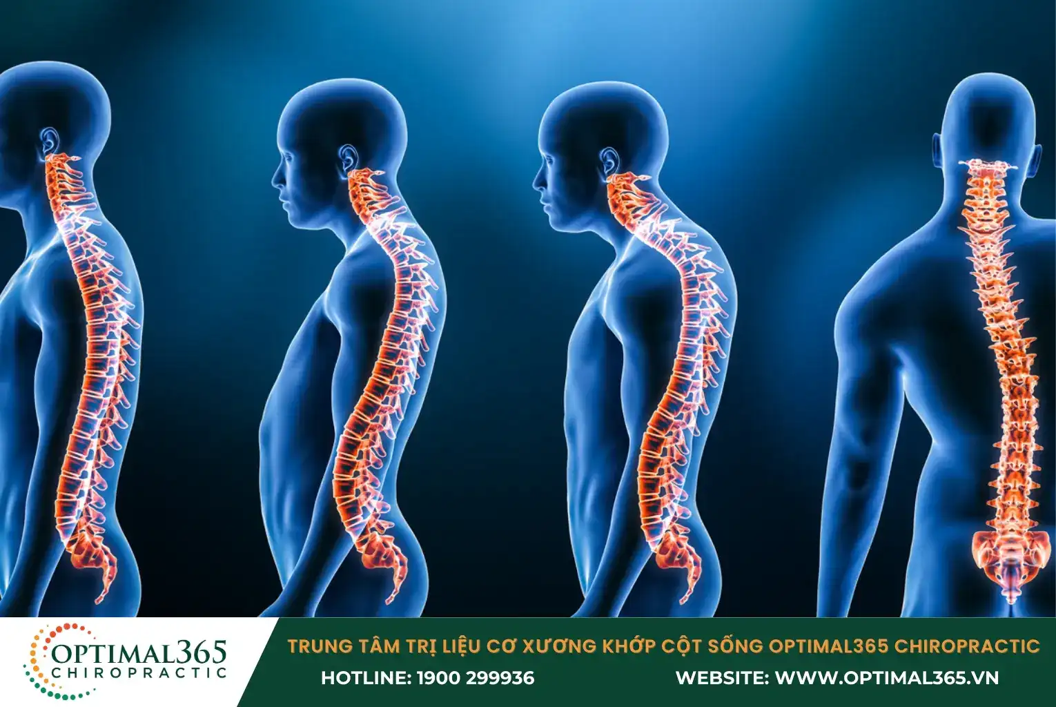 10 Bệnh Lý Gây Đau Cột Sống Phổ Biến:  Nguyên nhân, chẩn đoán và điều trị