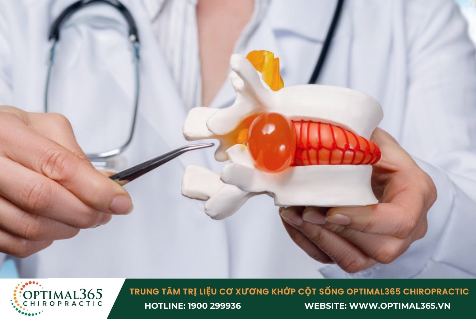 Thoát vị đĩa đệm cột sống thắt lưng là gì?