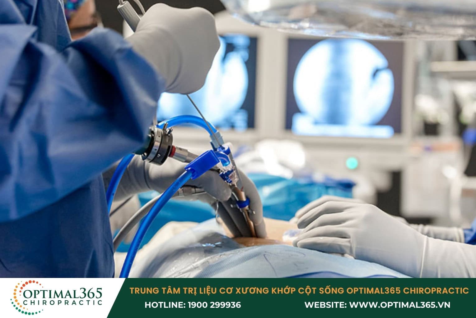 Khi nào cần phẫu thuật thoát vị đĩa đệm?