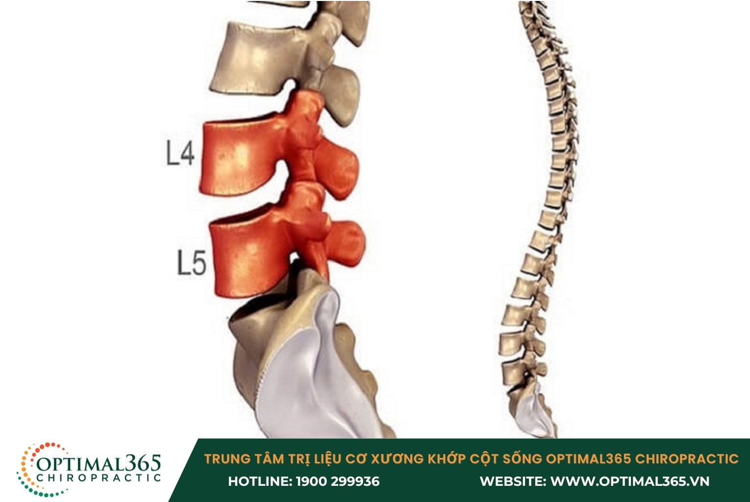 Thoái hóa cột sống thắt lưng là gì?