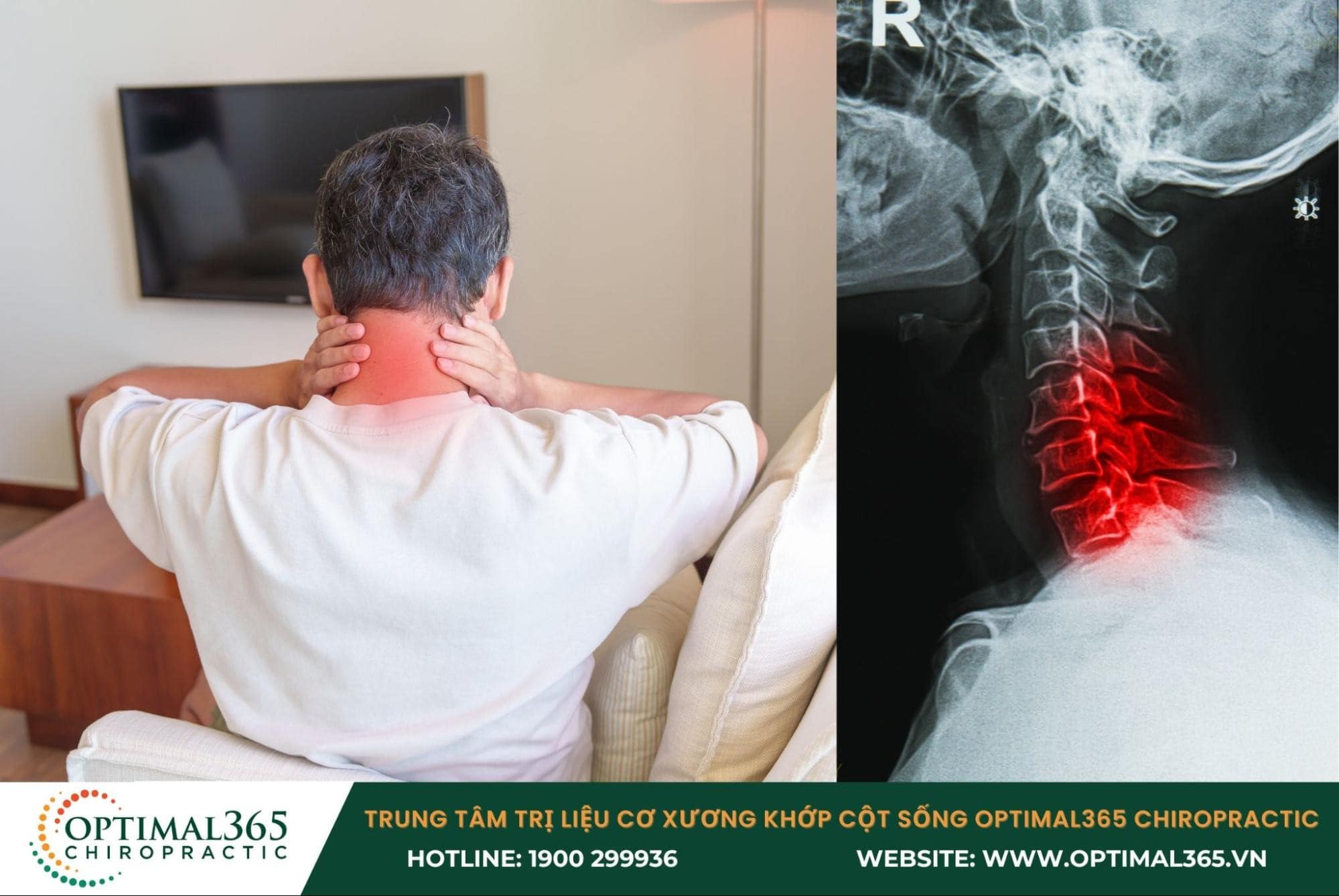 Bệnh lý thoái hóa đốt sống cổ là gì?