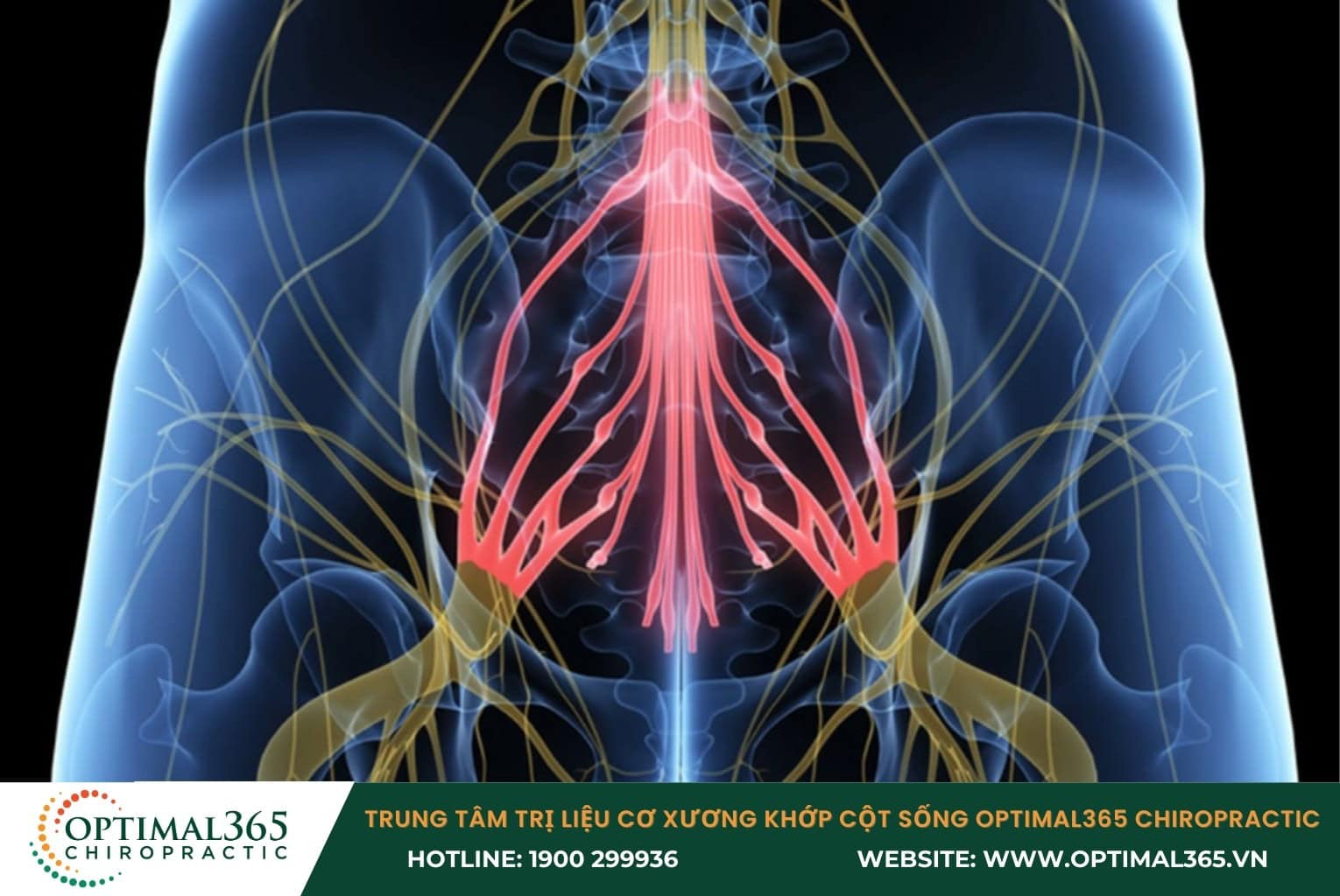 Triệu chứng của thoát vị đĩa đệm chèn ép dây thần kinh ở thắt lưng