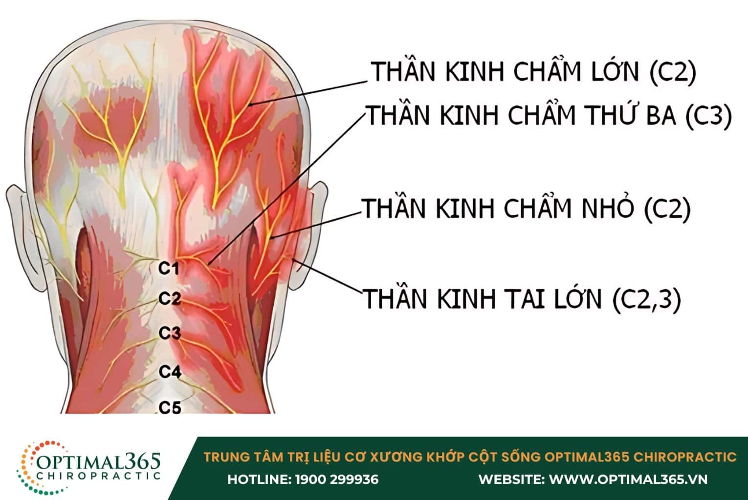 Triệu chứng của thoát vị đĩa đệm chèn ép dây thần kinh cổ