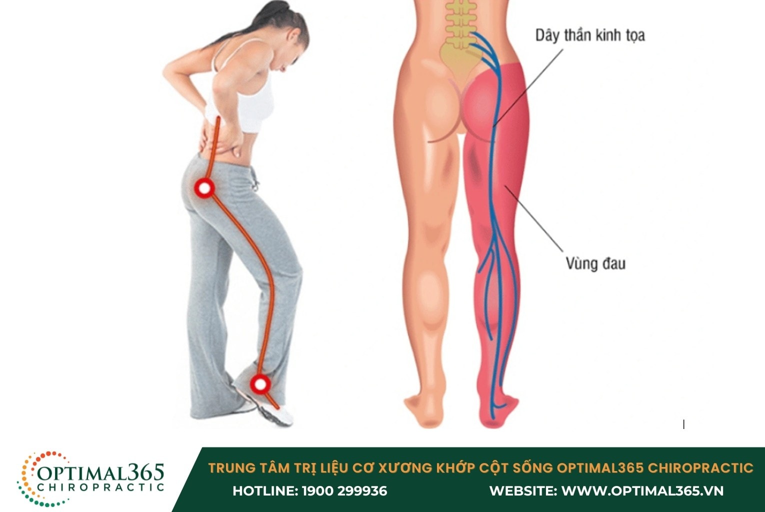 5 Biến chứng nguy hiểm của bệnh gai cột sống