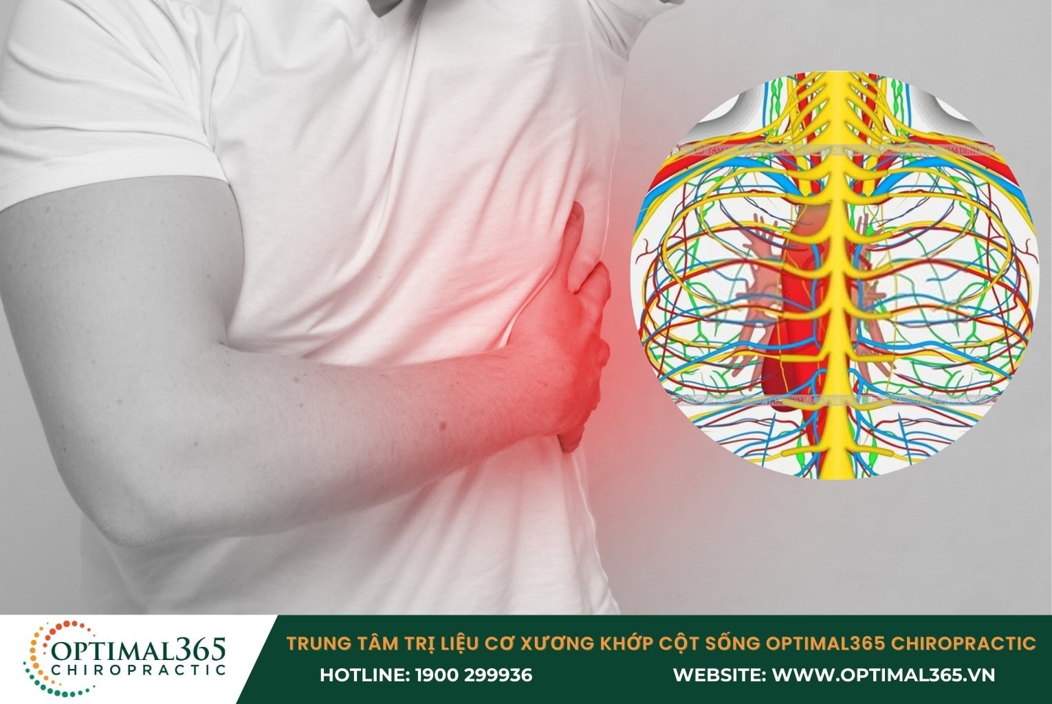 Tổn thương dây thần kinh liên sườn