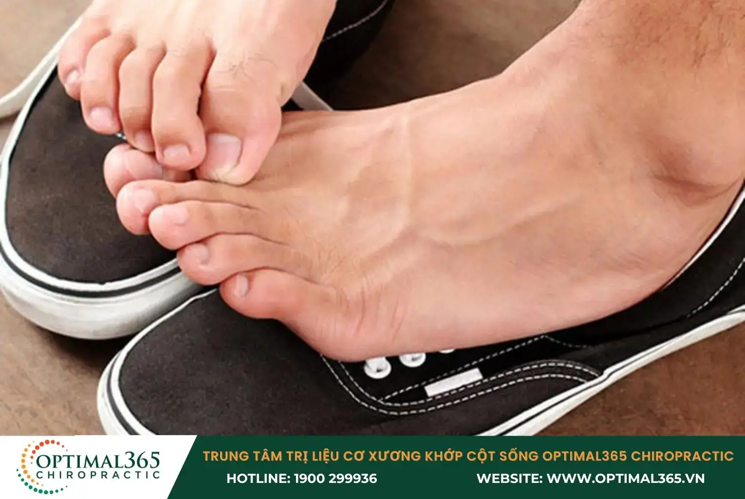 Giày quá chật hoặc quá rộng sẽ làm giảm sự ổn định của khớp, khiến bàn chân dễ bị trượt và vặn xoắn