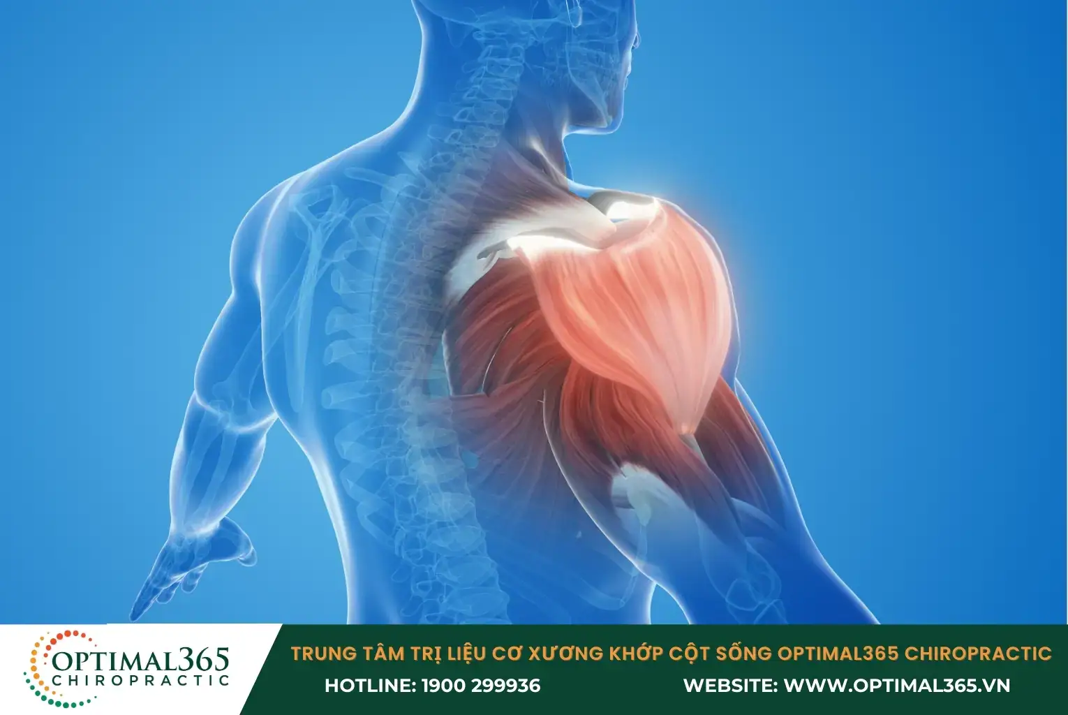 Chấn thương vai do té ngã, sai động tác khi chơi thể thao