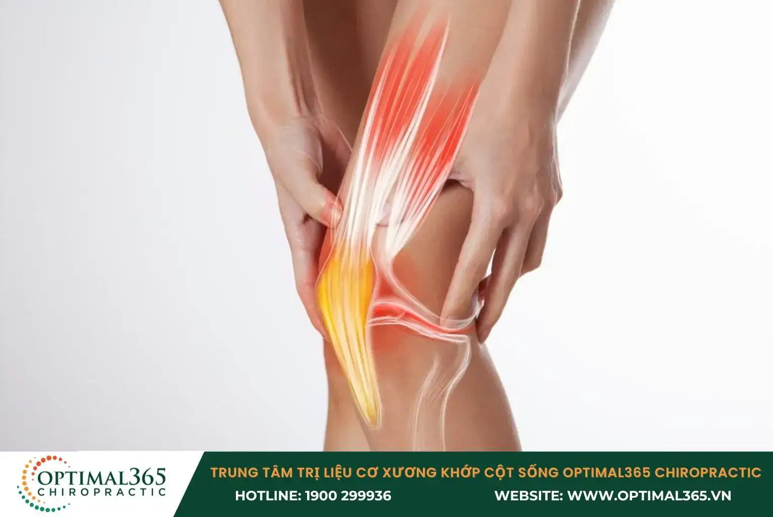 Anterior cruciate ligament injury causes knee pain and limits the patient's mobility