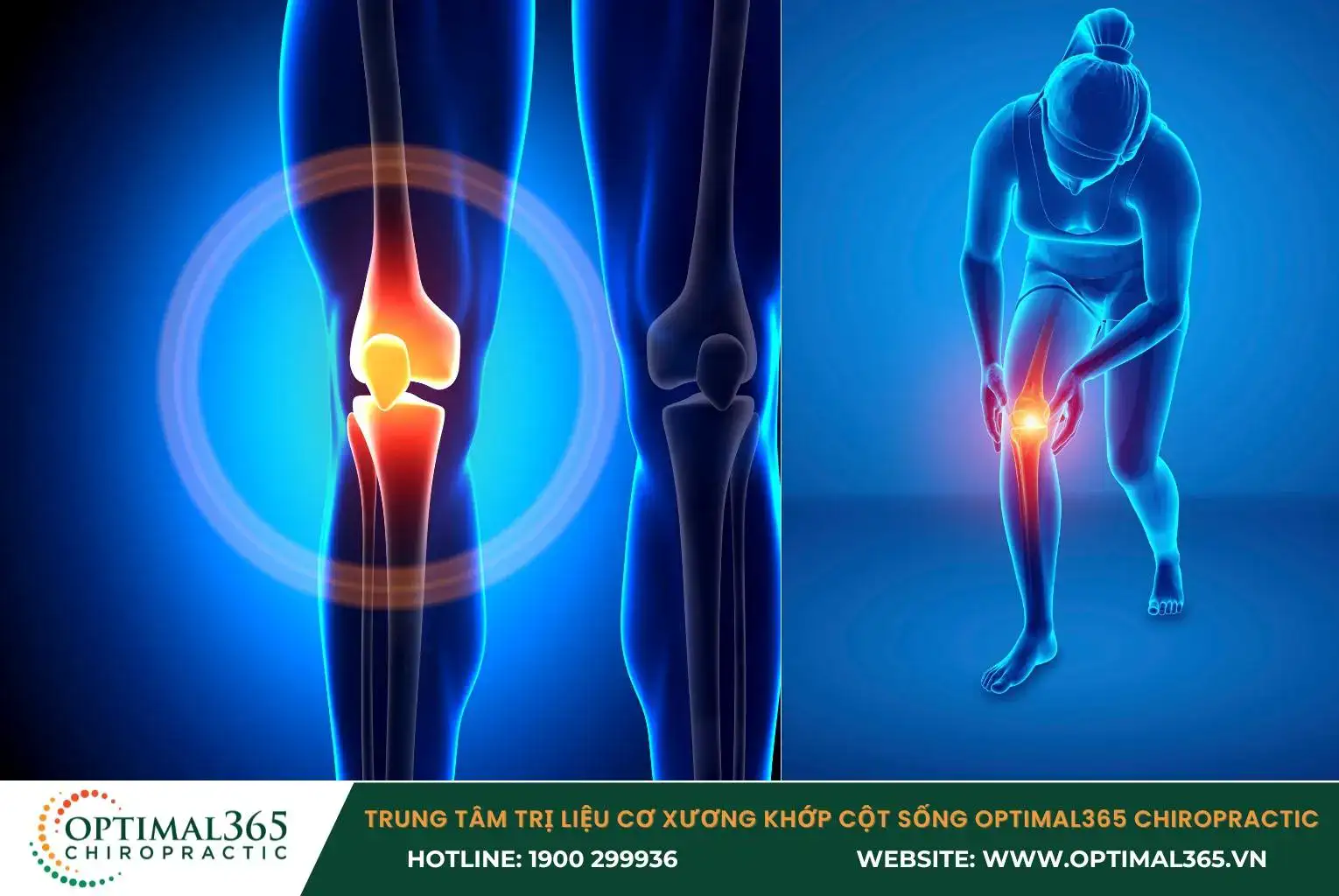Knee pain is the condition of damage to hard and soft tissues in the knee area.