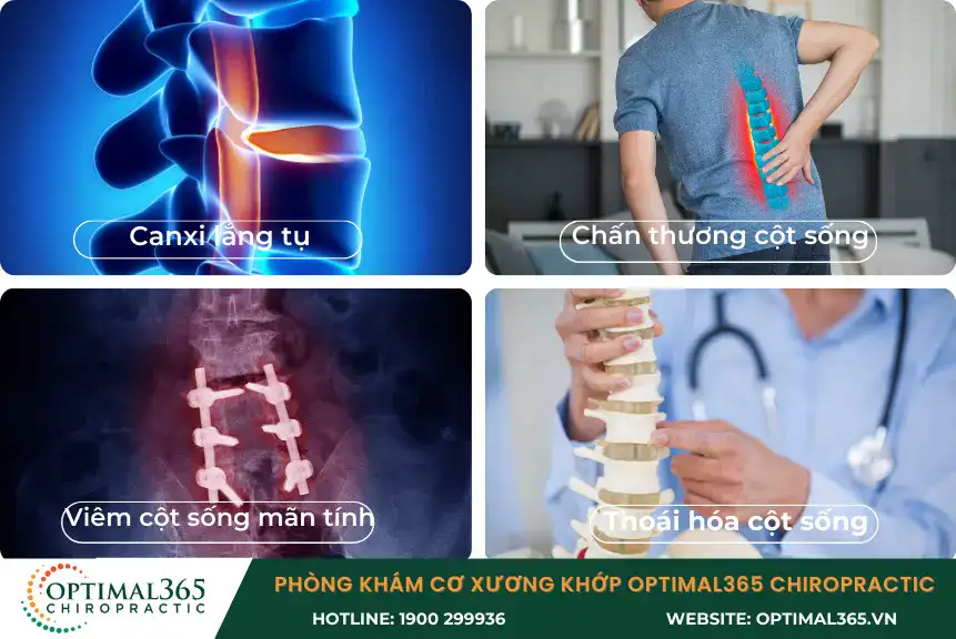 There are many causes of bone spur formation.