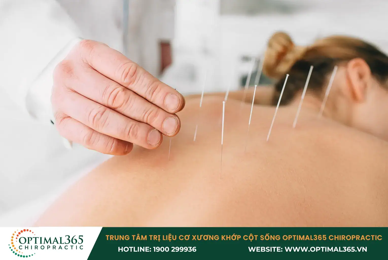 Acupuncture to Help Relieve Pain from Spinal Degeneration