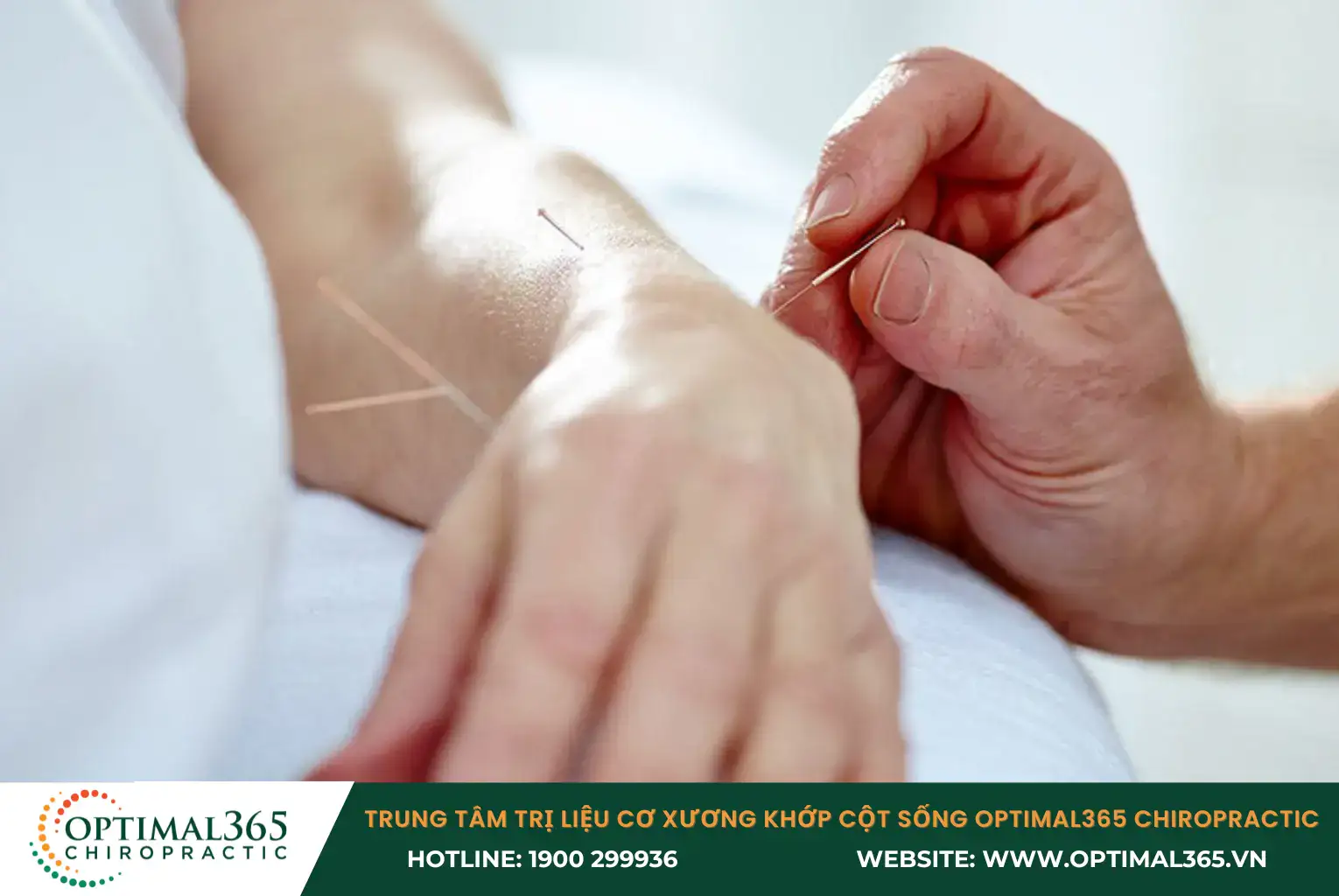 Acupuncture helps regulate qi and blood flow, promoting the body’s self-healing.