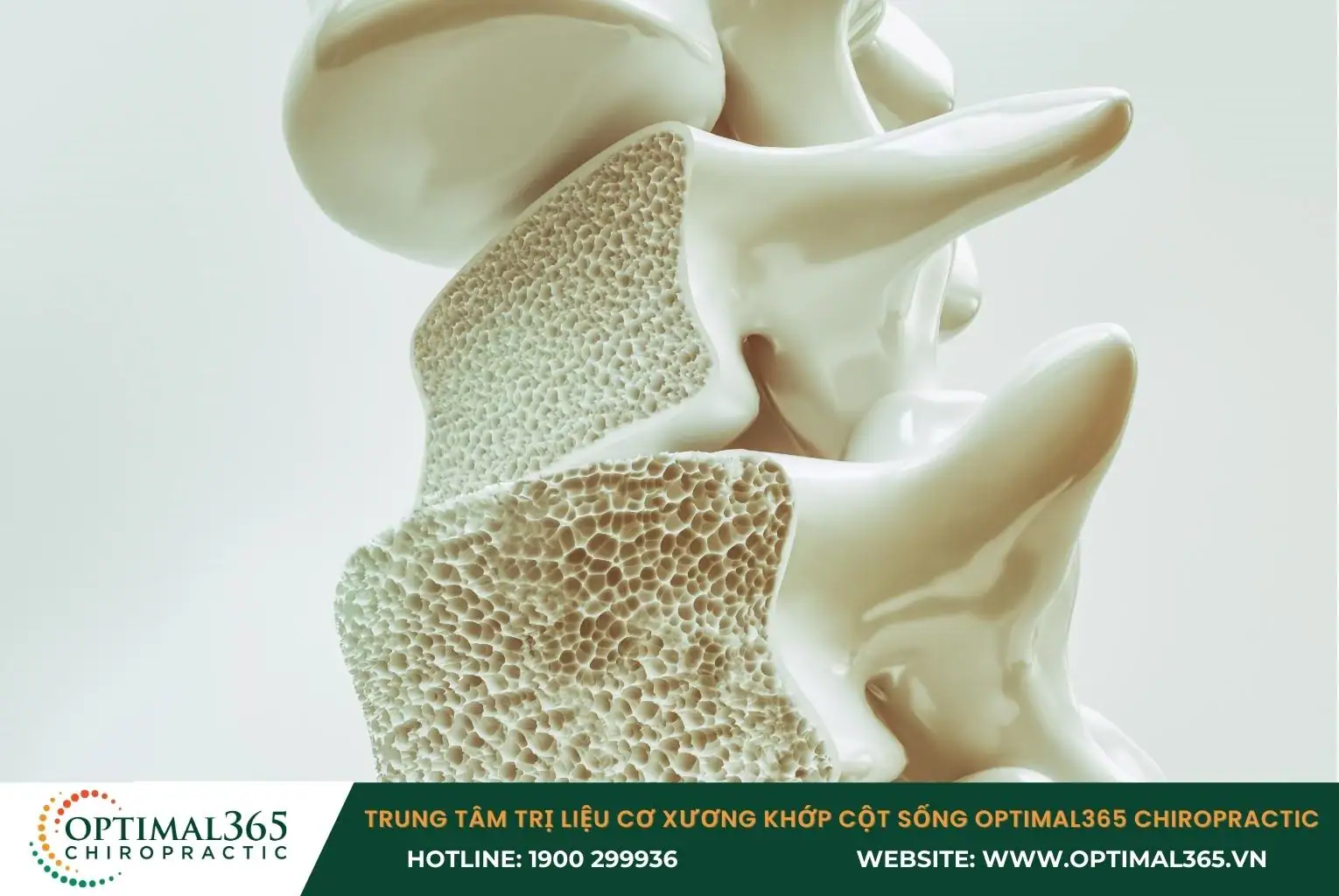 Loãng xương làm xương giòn, yếu và dễ gãy khi bị chấn thương