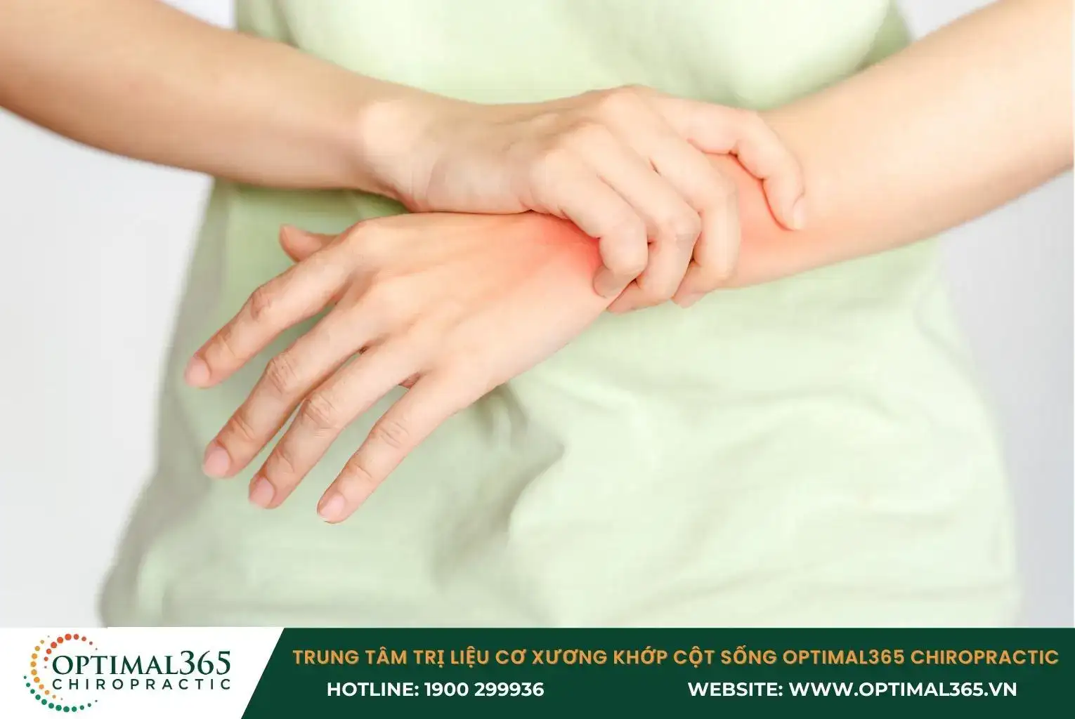 Hội chứng De Quervain làm giảm khả năng vận động ngón cái