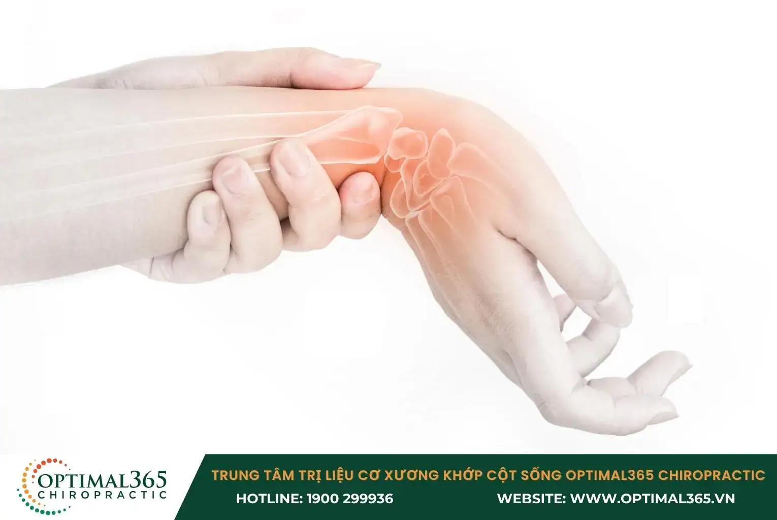 Trật khớp cổ tay làm mất tính ổn định cấu trúc xương