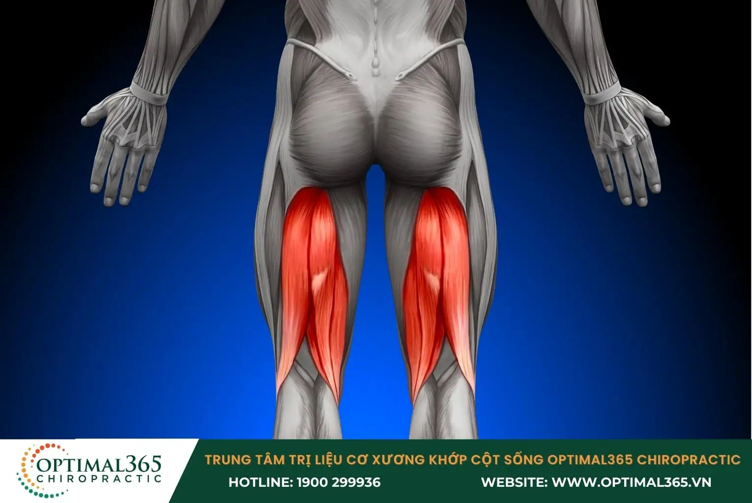 Chấn thương gân kheo xảy ra khi cơ sau đùi bị giãn quá mức hoặc rách