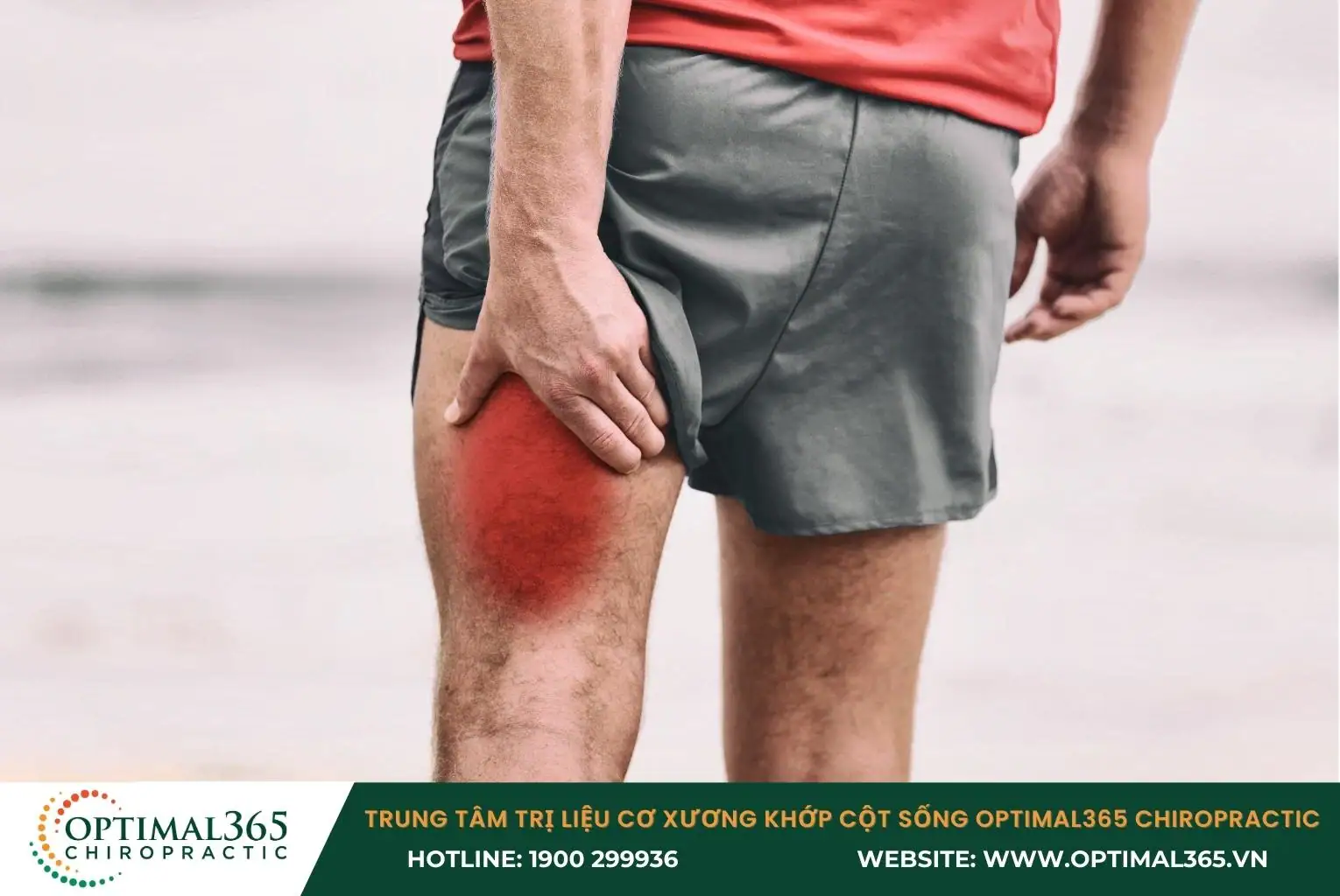 Chấn thương gân kheo làm vùng đùi sau sưng tím, đau nhói, khó di chuyển