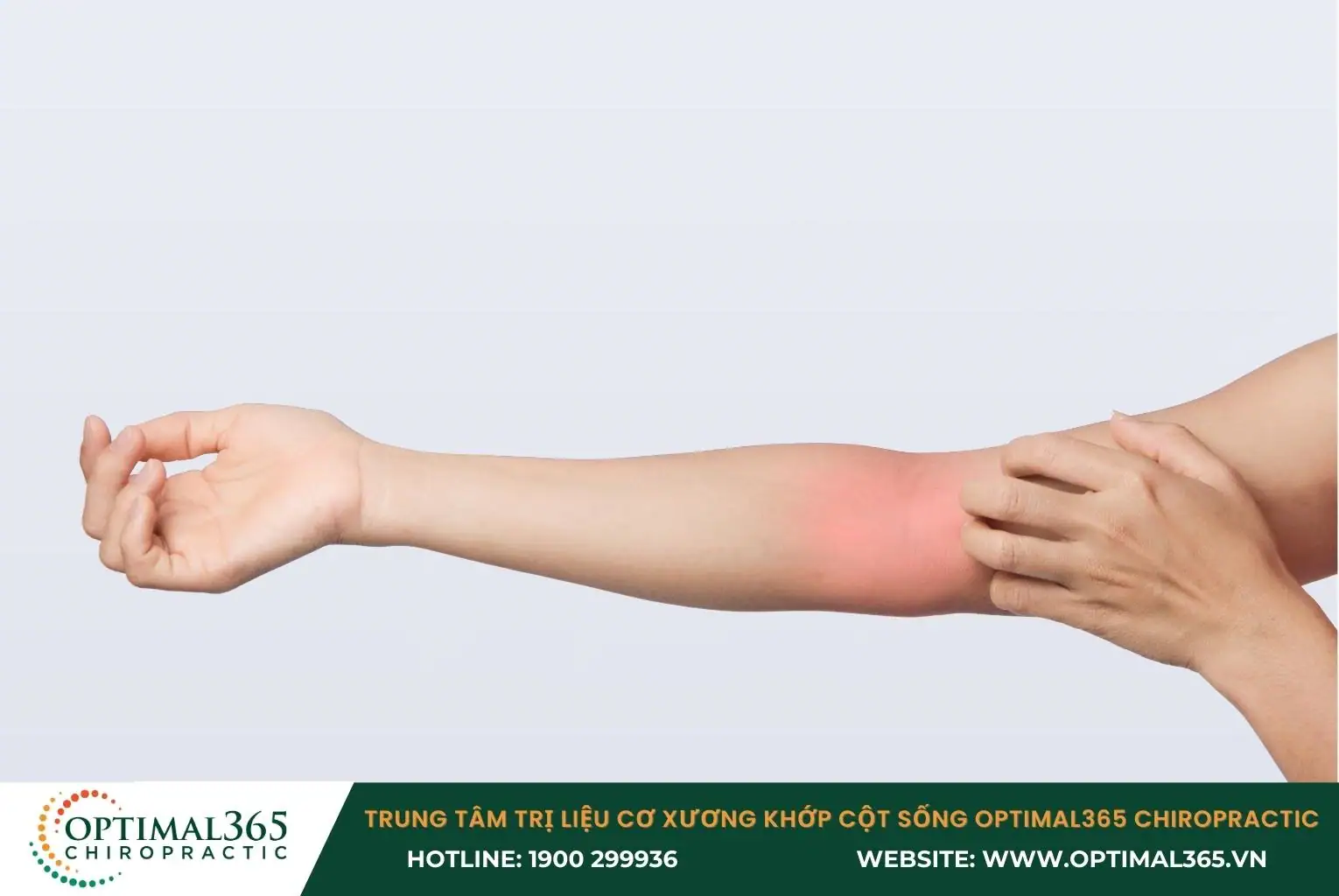 Viêm lồi cầu trong xương cánh tay