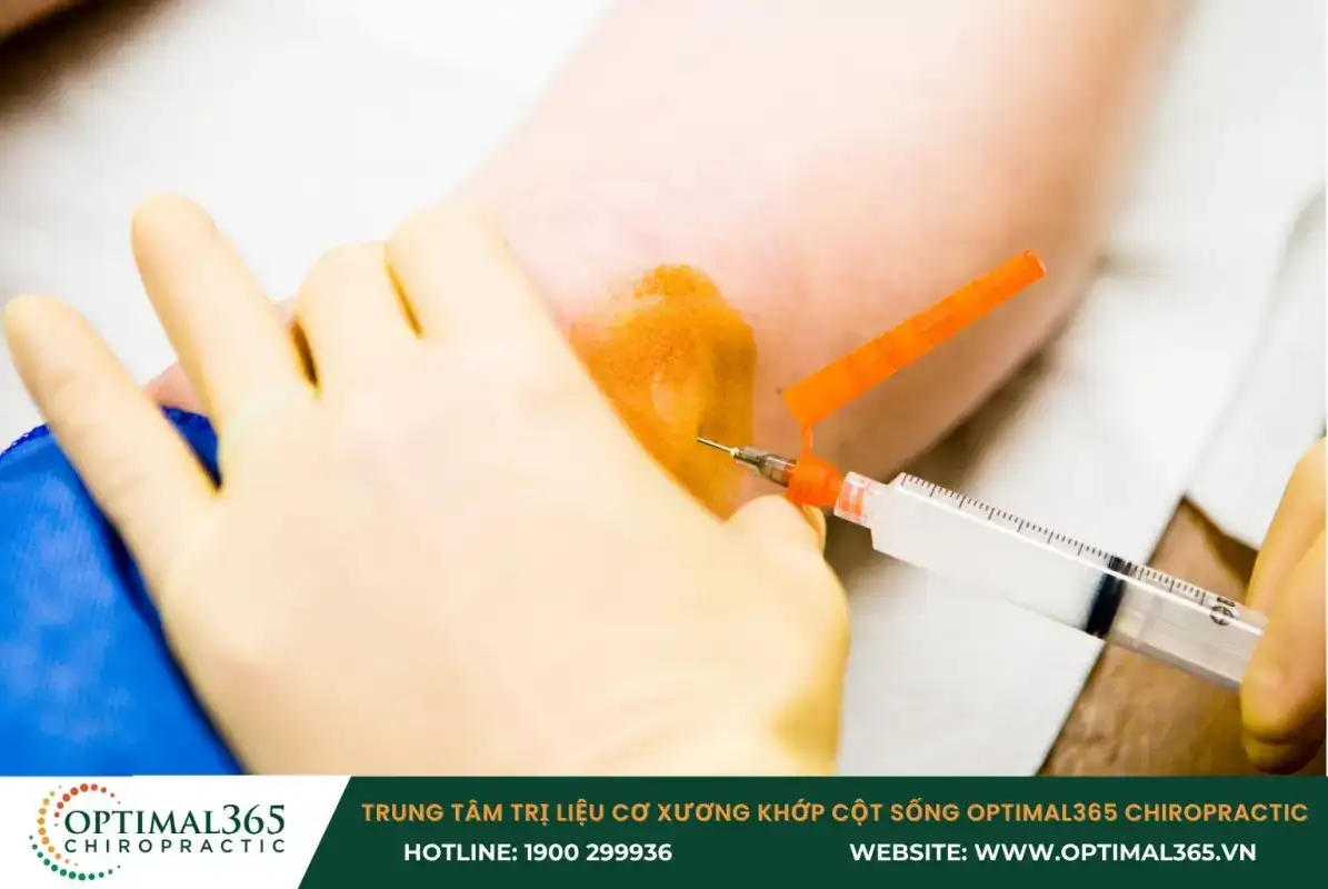 Hút dịch nhờn bị viêm nhiễm trong khớp