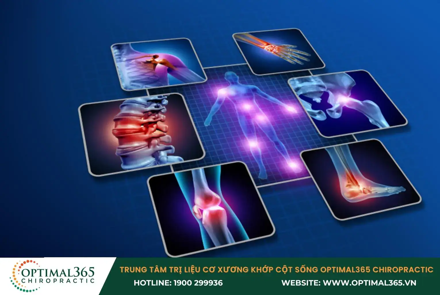 Bệnh lý cơ xương khớp, cột sống thường gặp