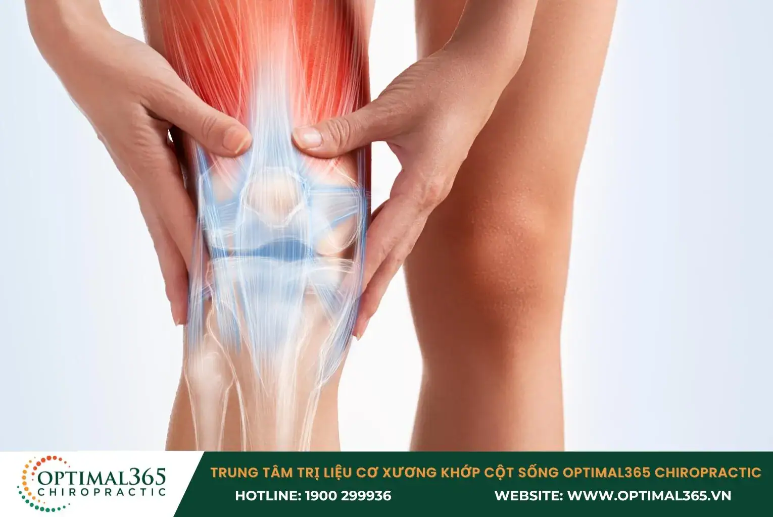 Viêm khớp gối là tình trạng mài mòn xương và sụn khớp gây viêm