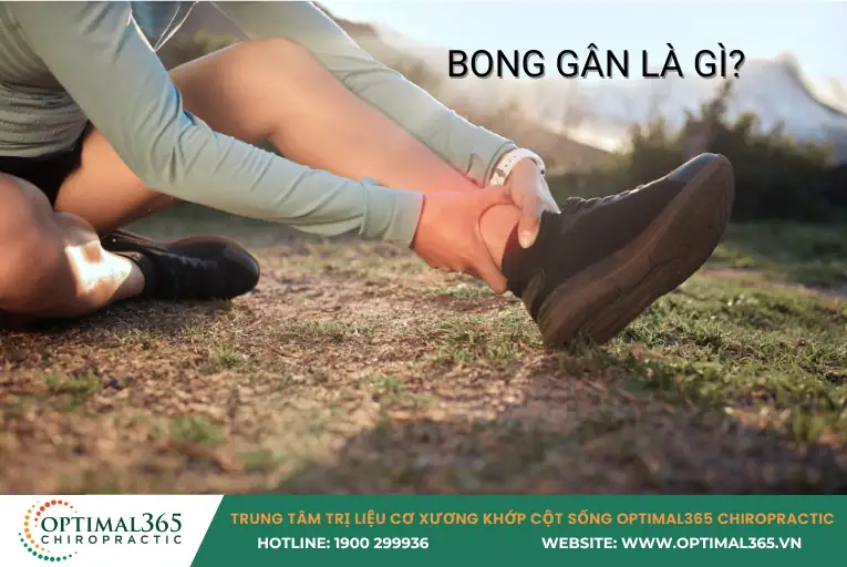 Bong gân là gì
