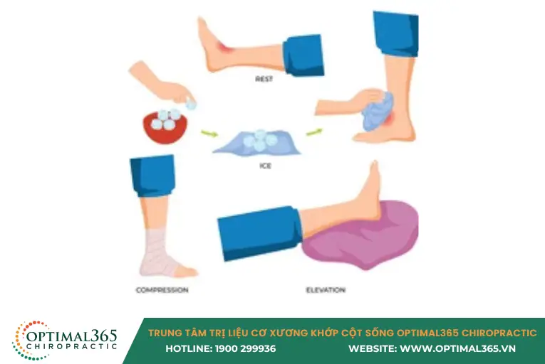 Sơ cứu khi bị bong gân