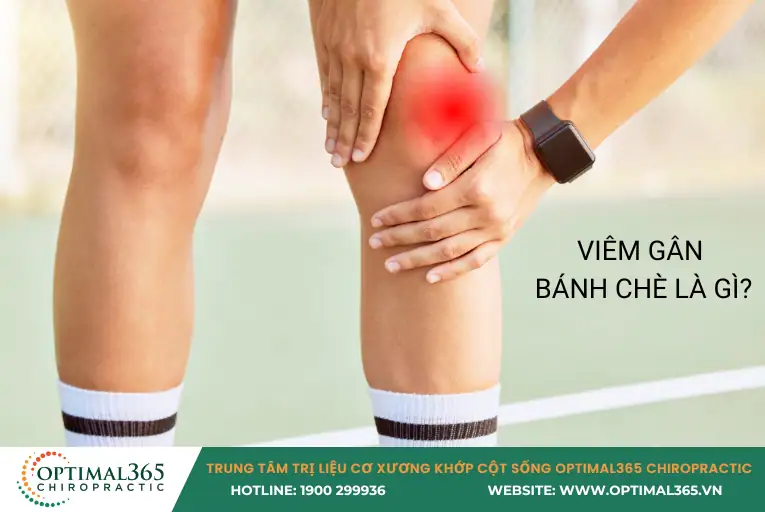 VIÊM GÂN BÁNH CHÈ LÀ GÌ