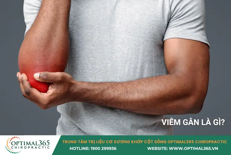 viêm gân là gì