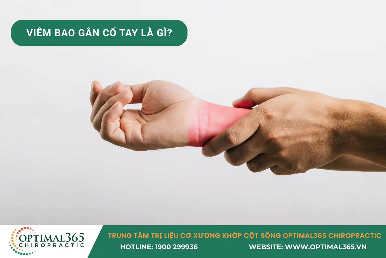 viêm bao gân cổ tay