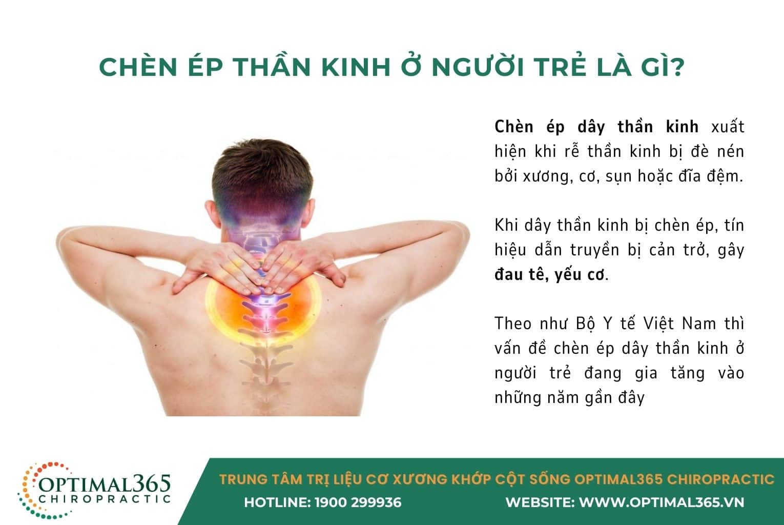 chèn ép dây thần kinh ở người trẻ