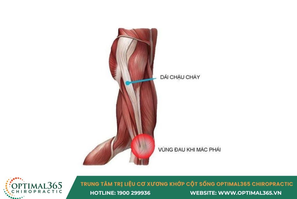 đau hông khi chạy bộ