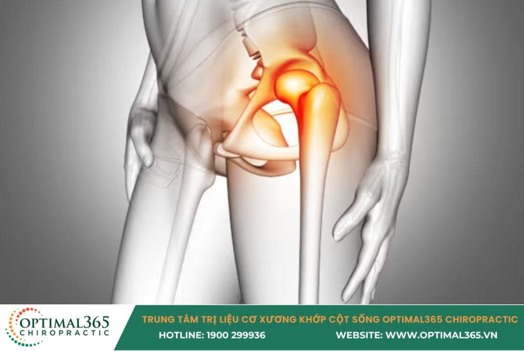 đau hông khi chạy bộ