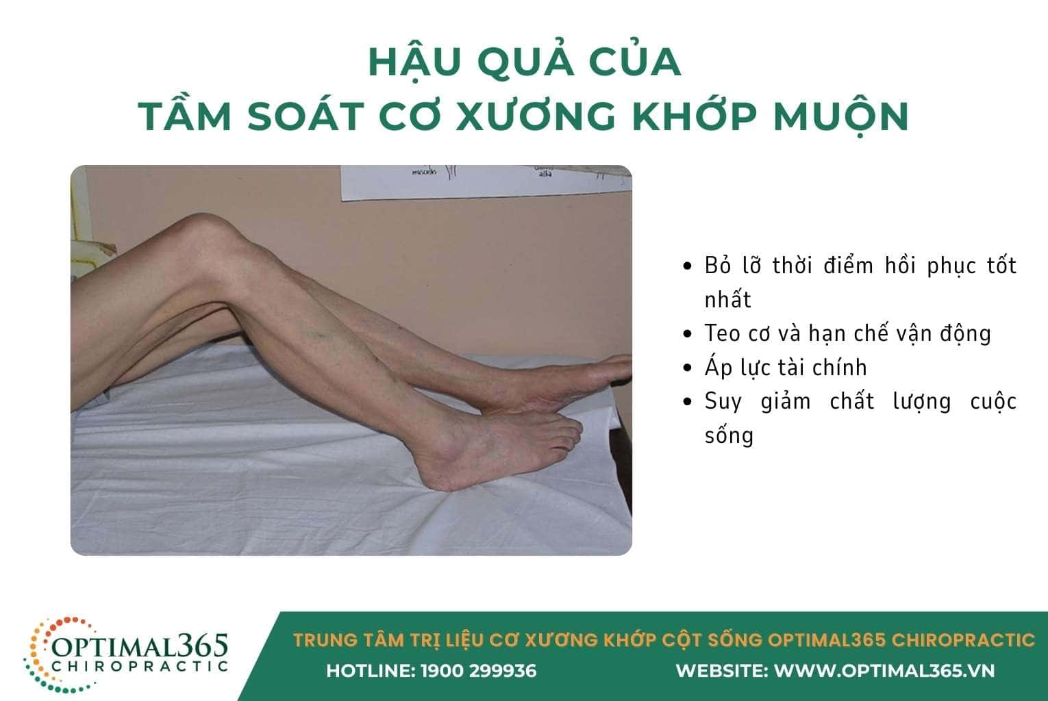 hau-qua-tam-soat-co-xuong-khop-muon