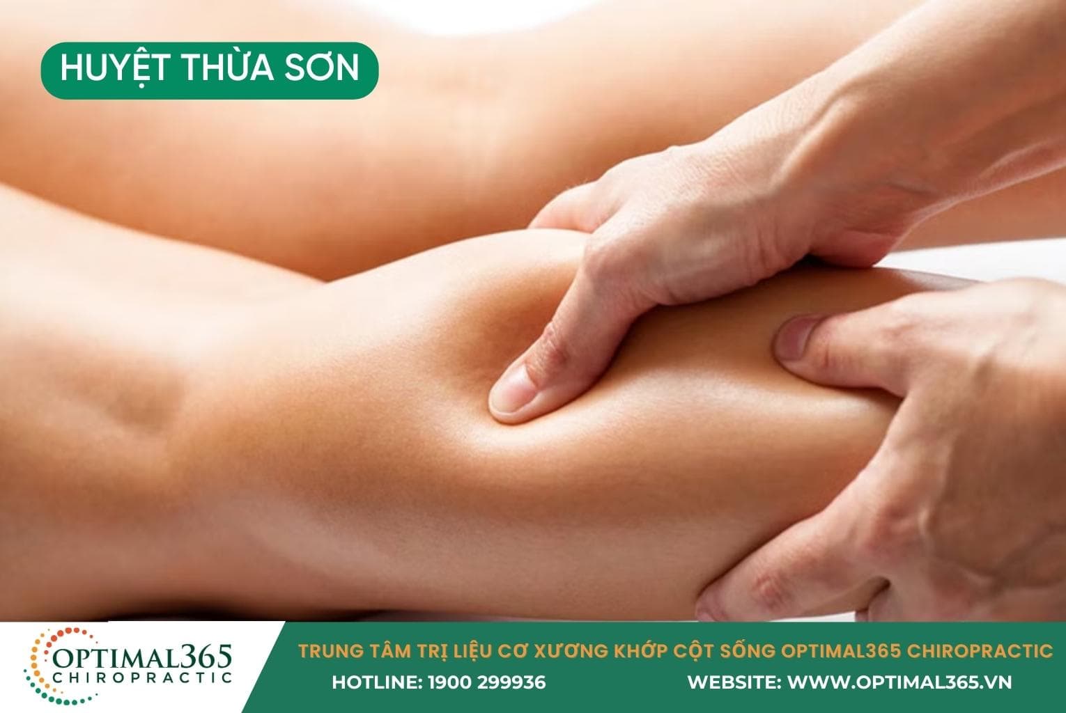 Vị trí huyệt Thừa Sơn (BL57) giữa bắp chân sau.