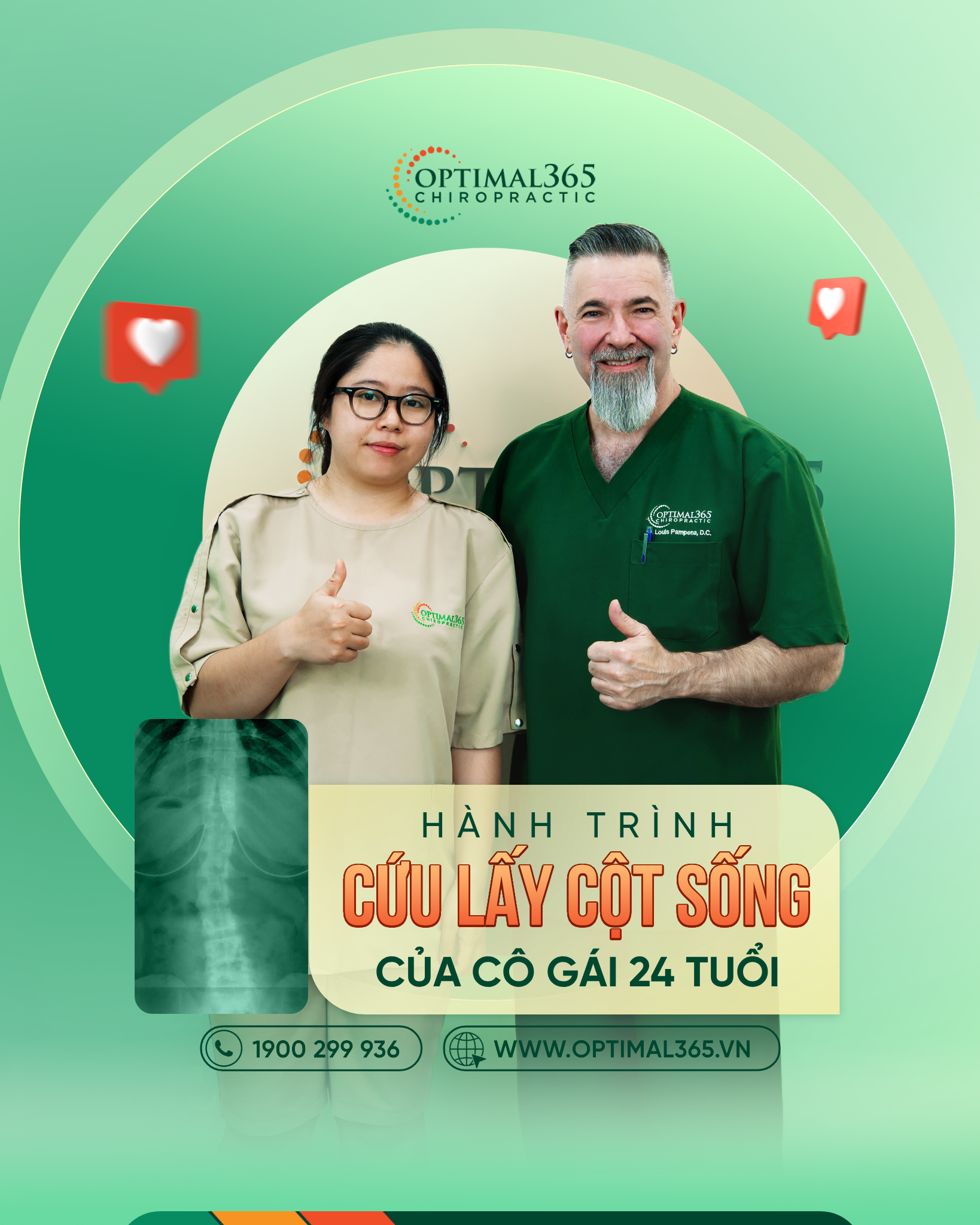 Câu chuyện khách hàng: Khắc phục cong vẹo cột sống ở tuổi 24 nhờ trị liệu Chiropractic tại Optimal365