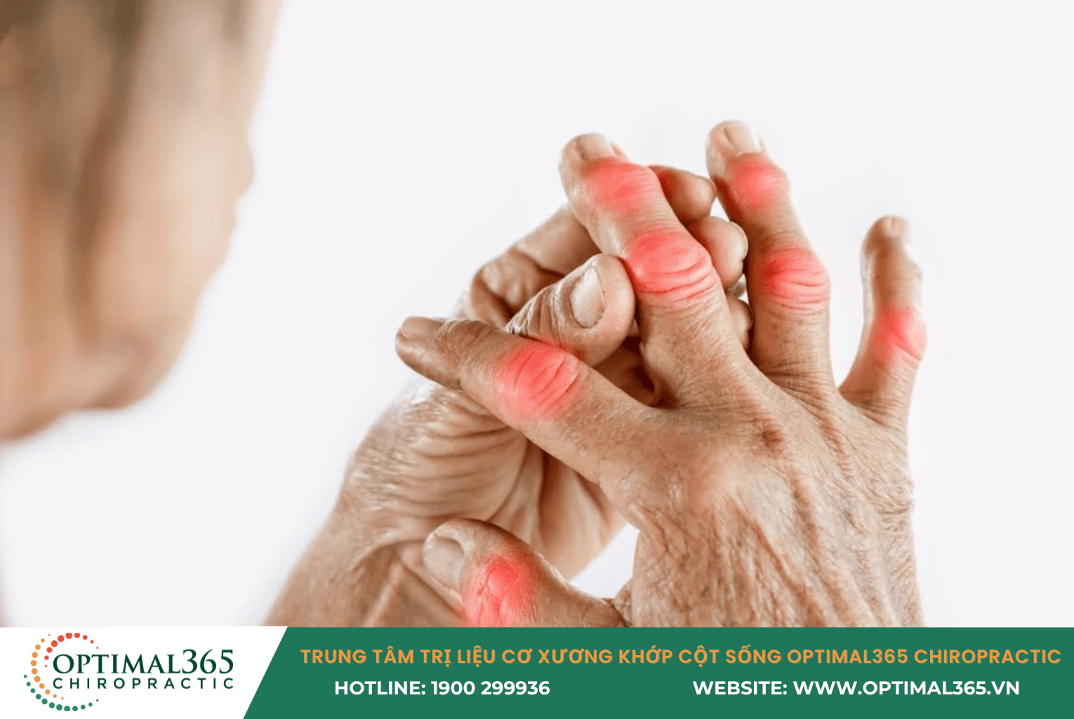 Viêm khớp ngón tay