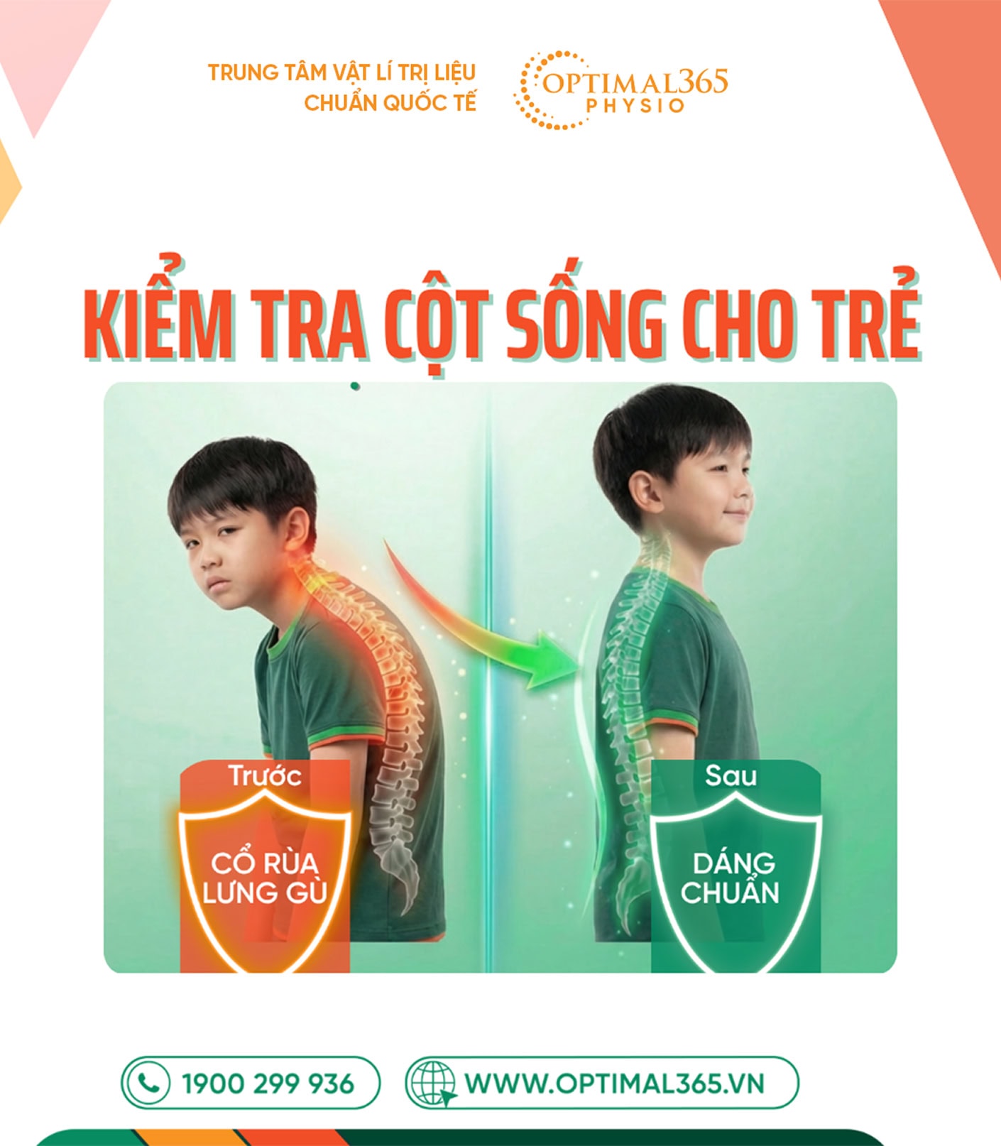 Kiểm tra cột sống cho trẻ: Cẩm nang vàng bảo vệ vóc dáng và sức khỏe toàn diện