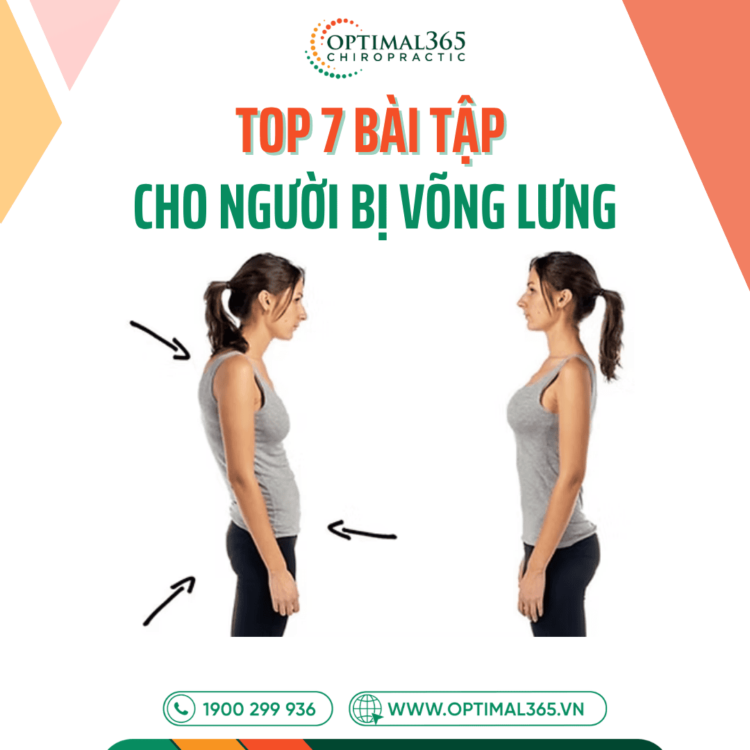 Top 7 bài tập cho người bị võng lưng giúp cải thiện vóc dáng và cột sống